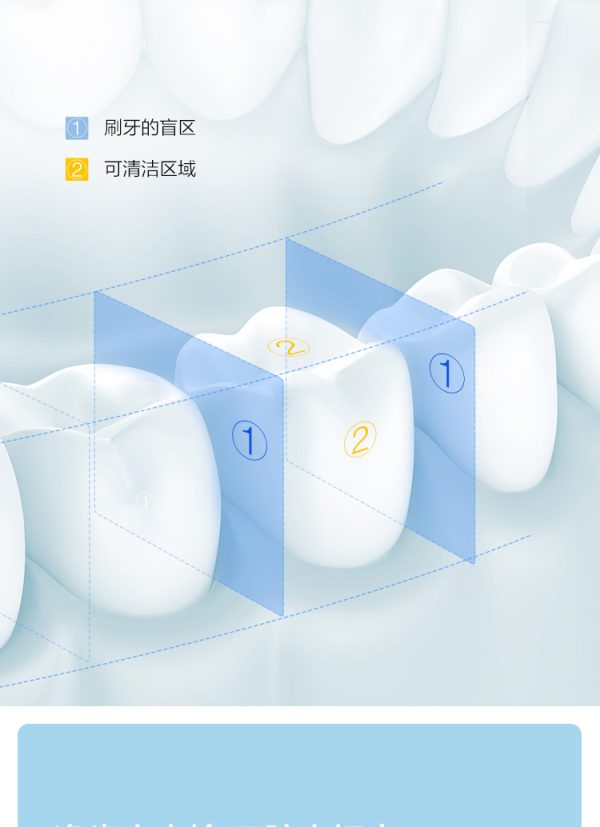 貝醫師YMYM電動沖牙器便攜式水牙線矯正智慧家用口腔用品YF3 YF3沖牙器：圖片 4